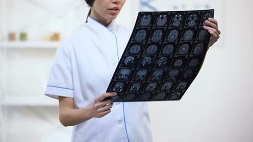 Health Professional Examining Brain Scans in Hospital