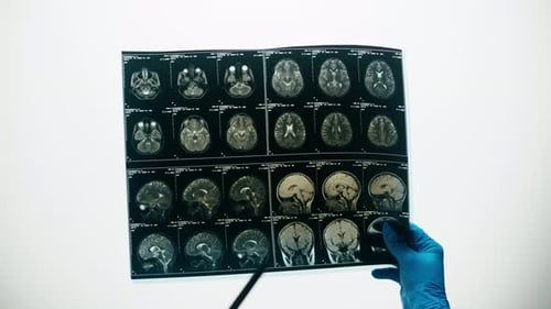 Hands Hold and Point to Brain Scan Image
