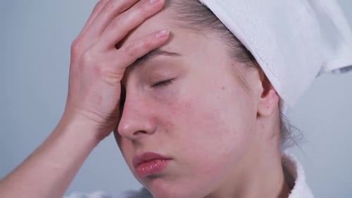 Mädchen schaut im Spiegel auf Problemhaut