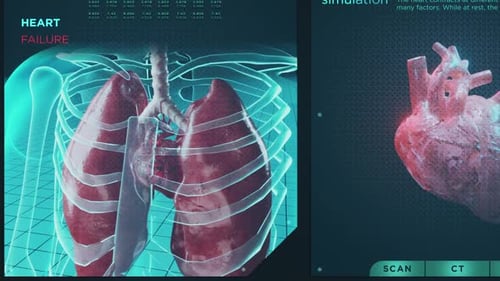 Heart Failure and Functions HUD