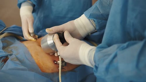 Instruments for Laparoscopic Surgery at Work