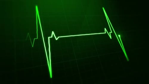 Digital EKG Pulse