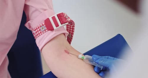 Close Up Needle Draws Blood in Hospital