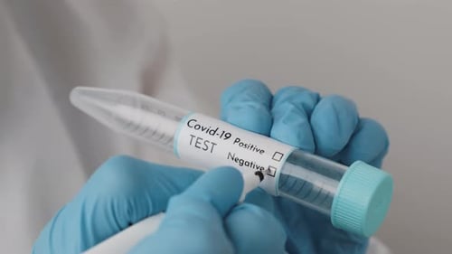 Marking Covid-19 Test as Negative Result
