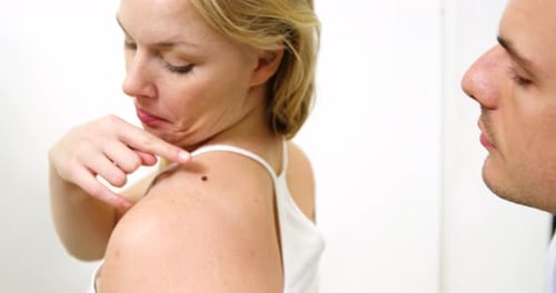 Woman Having Mole Examined by Doctor Close Up