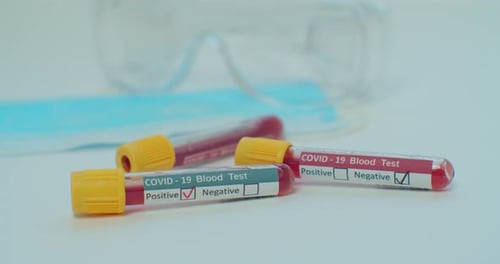 COVID-19 Blood Tests with Medical Equipment