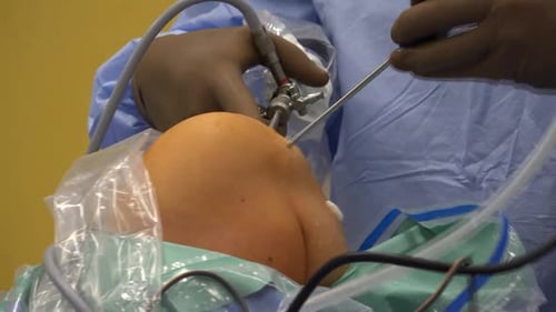 Medical Staff Performing Knee Arthroscopic Procedure