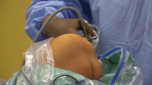 Surgeon Performing Arthroscopic Knee Surgery with Tools