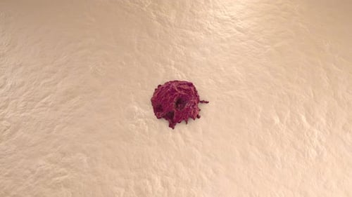 Microscopic view on a growing Cancer Tumor on healthy tissue