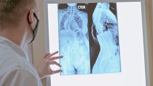 Doctor Reviews Spine X-Ray in Medical Office