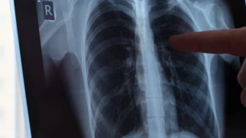 Lungenradiographie Konzept