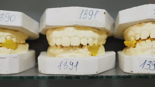 Dental Molds with Teeth Replicas in Lab