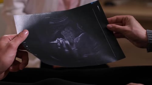 Mains des futurs parents avec une image échographique