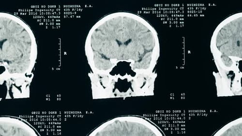 Medical Brain Scan Close Up View