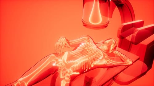 X-ray Examination Medical Scan Footage