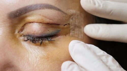 Doctor Examines a Patient, Close-up of the Eyelids