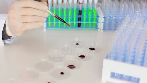 Close Up Footage of a Researcher's Hands Dripping a Blood Samplesin a Petri Dishes. Modern