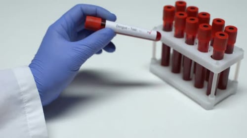 Positive Dengue Test Result Blood Sample