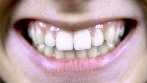 Young Woman Shows Crooked Teeth. Close-up