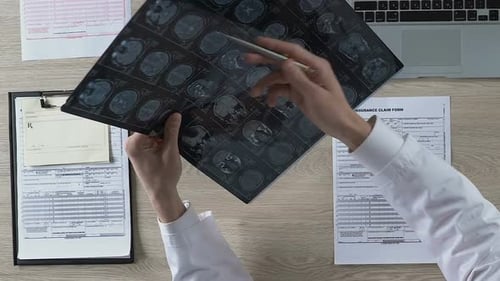 Doctor Examines X-Ray at Office Desk
