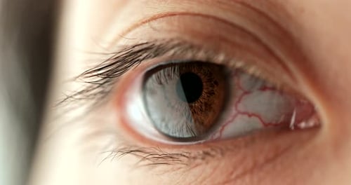 Woman Red Blood Eye