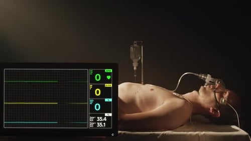 Male in Coma, Heart Rate Falling To Zero on Ecg Monitor, Patient Death, Health.