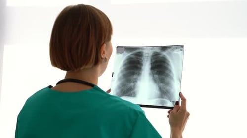 Young Woman Doctor is Looking at Chest Xray While Standing in Modern Clinic Spbas