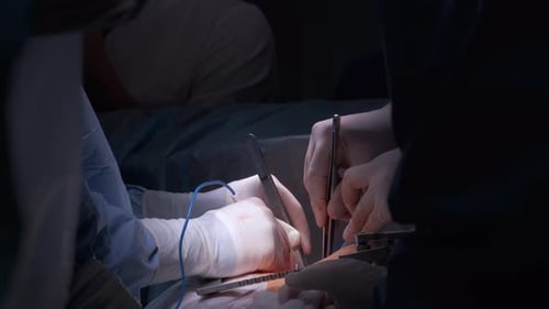 Surgeons Performing Operation in Dimly Lit Operating Room