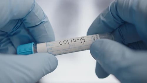 Close Up of COVID-19 Sample Tube in Hospital