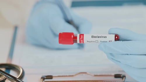 Positive Ebola Virus Test in Laboratory Setting