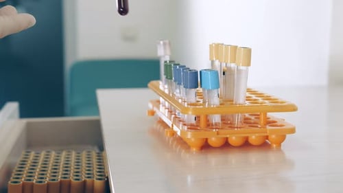 Blood Sample Placed in Test Tube Rack