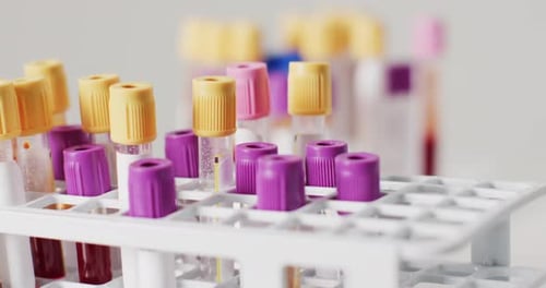 Video of close up of test tubes on white background