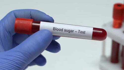Blutzuckertest, Arzt hält Blutprobe im Röhrchen, Nahaufnahme, Gesundheitsuntersuchung