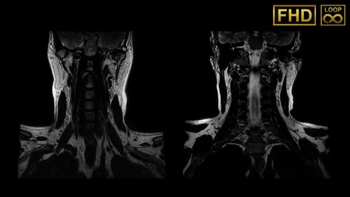 Detailed Human Neck and Spine MRI Scan Rotation