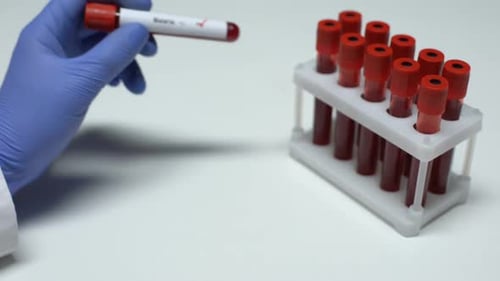 Test positif de paludisme, médecin montrant un échantillon de sang, recherche en laboratoire, bilan de santé