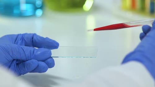 Epidemiologe tropft Blutprobe auf Glas, analysiert Biomaterial, Virus