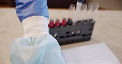 Medical Worker Handling COVID19 Positive Blood Sample