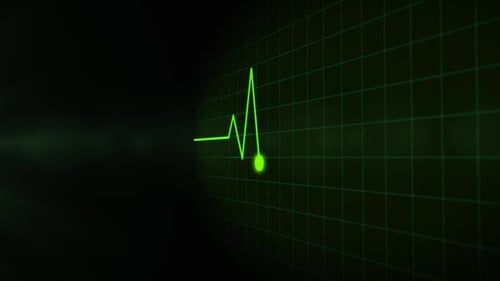 Digitaler EKG-Impulskopierraum
