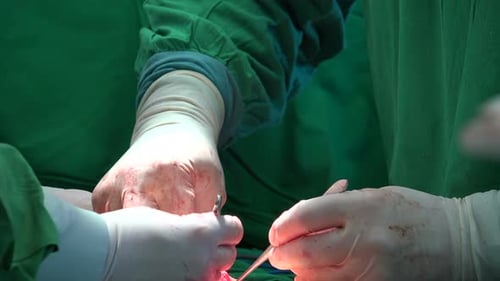 Surgeons Performing Delicate Operation in Hospital