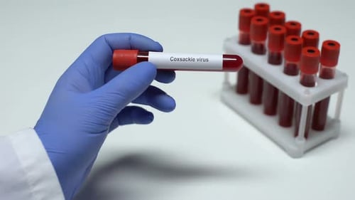 Coxsackie-Virus