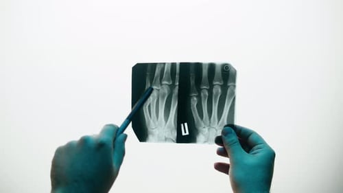 Hand Fingers Xray Closeup