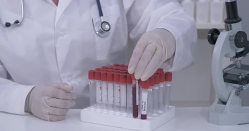 Medical Professional Testing Blood Sample for COVID-19