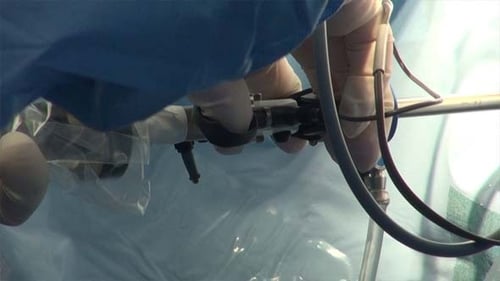 Surgeon Hands Manipulating Surgical Instruments for Procedure