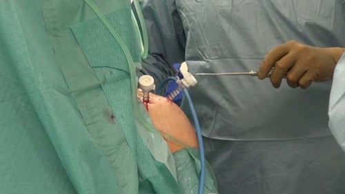 Surgical Procedure with Ports on Operating Table