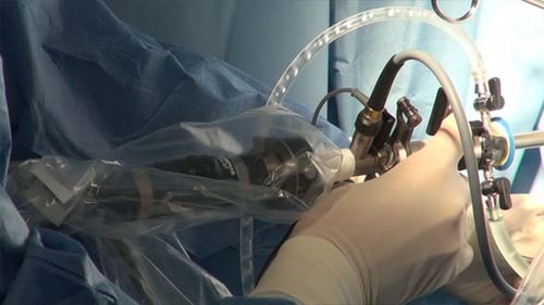 Surgeon Operating Endoscope During Medical Procedure