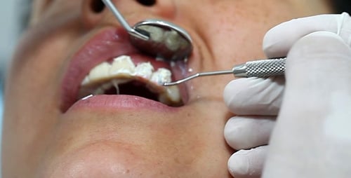 Young Girl in Dentist 6