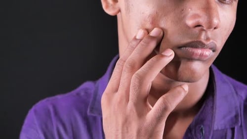 Nahaufnahme des Gesichts eines jungen Mannes mit Hautproblem