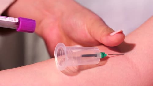 Blood Test