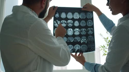 Male and Female Medics Holding and Studying MRI Images Discussing Case in Hospital