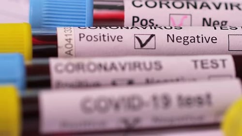 Covid-19 Positive Blood Samples in Laboratory